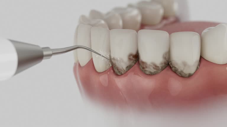 Reliable Teeth Cleaning And Checkup contractor in Colbert County County, AL by Dentist Open Now